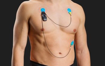 Holter Monitoring